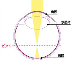 斜視のない状態