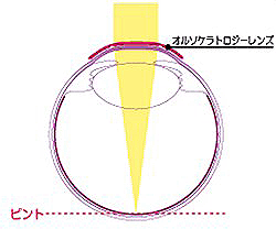 斜視のない状態