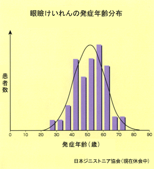 眼瞼けいれんの発症年齢分布