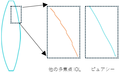 レンズ表面