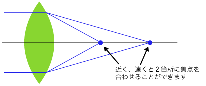 遠近両用眼内レンズ