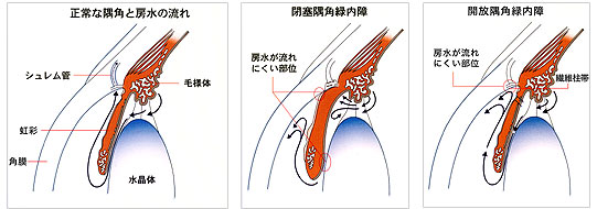 房水の流れ