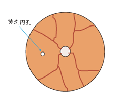 正面図