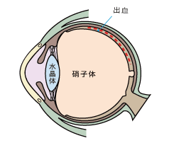 断面図