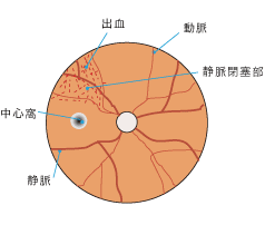 正面図